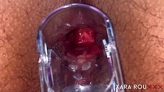 Mature woman undergoes speculum examination