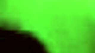 Gemma Massey has sex with the doctor who did her surgery