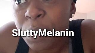 Penial Yeast Infection In Ebony Milf Amateur